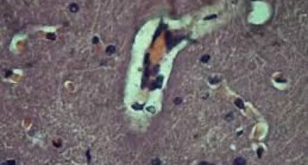 Медициналык биология, генетика жана паразитология кафедрасы