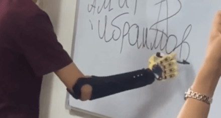 Студенты КГМА помогают зарубежным биоинженерам в подготовке бесплатных электронных протезов