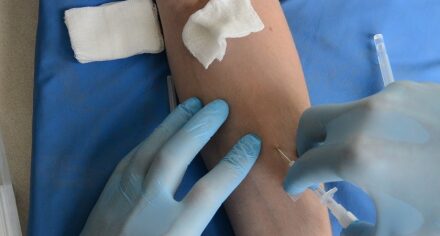 Алгоритм пункционной катеризации периферических вен (ЦДО и ПК КГМА)