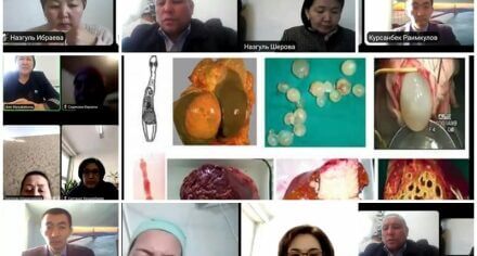 КММАда "Мите курт ооруларынын башаты" конференция болуп өттү